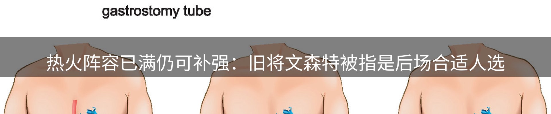前沿动态